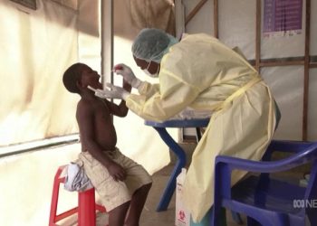 COVID 이어 mpox… 아프리카 지역 확산으로 각국 보건당국 ‘긴장’