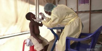 COVID 이어 mpox… 아프리카 지역 확산으로 각국 보건당국 ‘긴장’