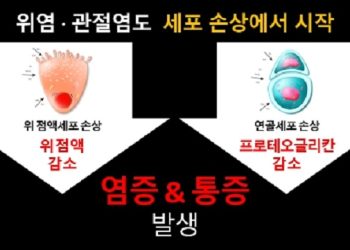 건강 정보- 무서운 통증, 관절염·위염 예방하려면 세포 손상 도미노 막아야