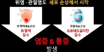 건강 정보- 무서운 통증, 관절염·위염 예방하려면 세포 손상 도미노 막아야