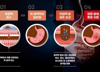 건강 정보- 중년 위 건강 주의보, 벌집 밀랍 비즈왁스알코올 도움