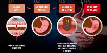 건강 정보- 중년 위 건강 주의보, 벌집 밀랍 비즈왁스알코올 도움