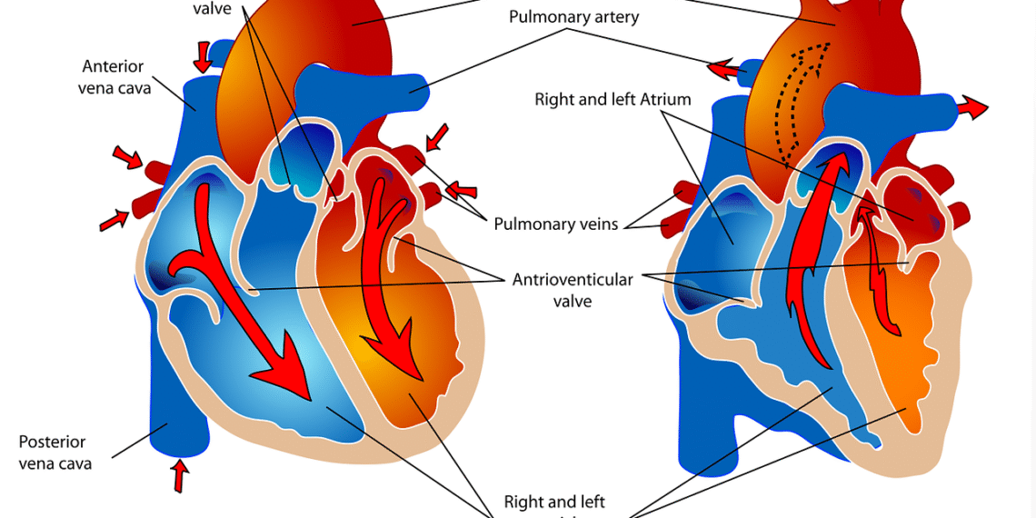 고혈압환자 대상, 쿠바산 폴리코사놀 20mg 12주 섭취 시 혈압 10% 낮아졌다