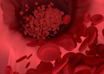 고혈압환자 대상, 쿠바산 폴리코사놀 20mg 12주 섭취 시 혈압 10% 낮아졌다