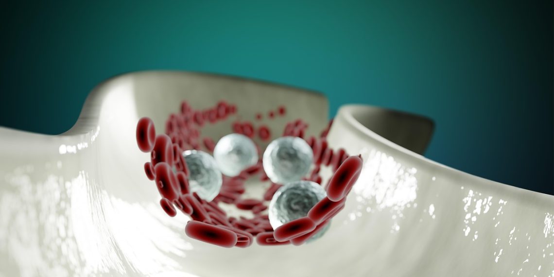 심혈관질환 예방하려면 HDL 높여 ‘콜레스테롤 디톡스’ 해야