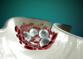 심혈관질환 예방하려면 HDL 높여 ‘콜레스테롤 디톡스’ 해야